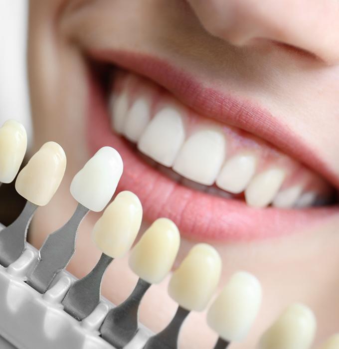 Cosmetic Dentistry Lansing, MI | Teeth Whitening | Porcelain Veneers