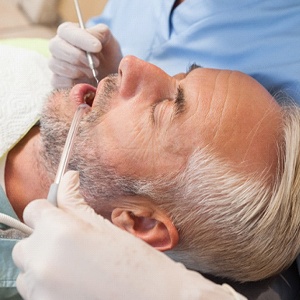 Man laying in dental chair during consult