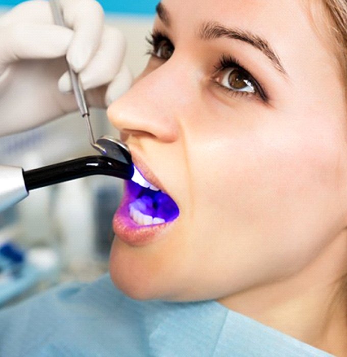 woman getting dental bonding