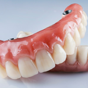 A closeup of a pair of implant dentures