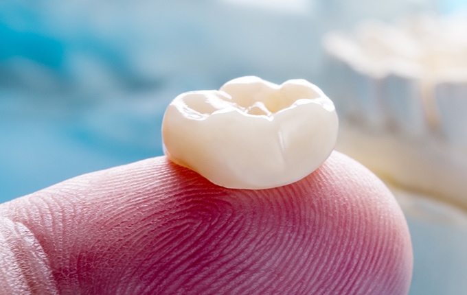 Dental crown resting on a fingertip
