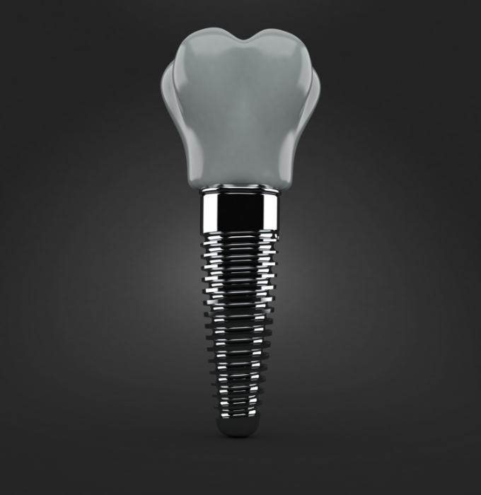 Aniamted dental implant supported dental crown