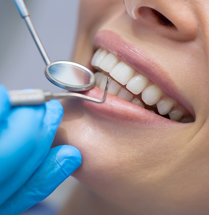 Closeup of smile during scaling and root planing