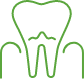 Large animated tooth with gum tissue