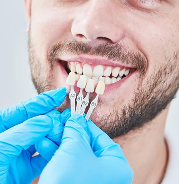 dentist holding a few veneers up to a patient’s smile